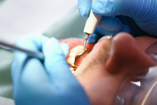 Best Broken Tooth Emergency  in Rhinelander, WI